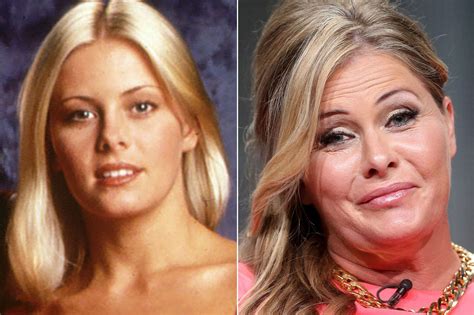 baywatch summer quinn|nicole eggert before and after.